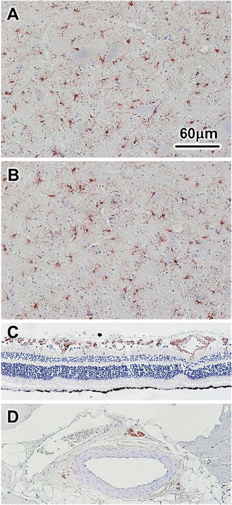 Gfap Ihc Stained Sections Of Cervical Spinal Cord Ventral Horn A