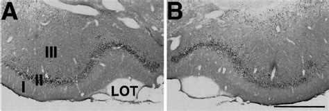 Fos Staining In The Piriform Cortex Sections Were Stained For Fos Download Scientific Diagram