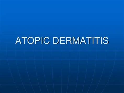 Ppt Atopic Dermatitis Powerpoint Presentation Free Download Id756740