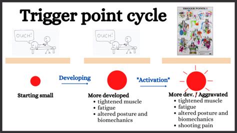 Trigger point release explained | Trigger point release explained