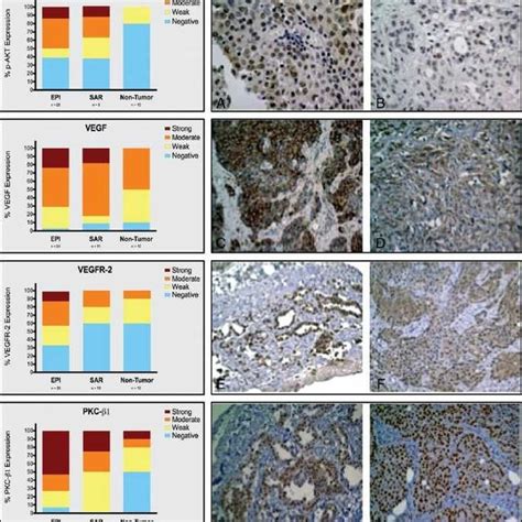 Expression Of Vegf Vegfr And Some Of Its Key Downstream Target