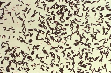 Clostridium Perfringens Microscope