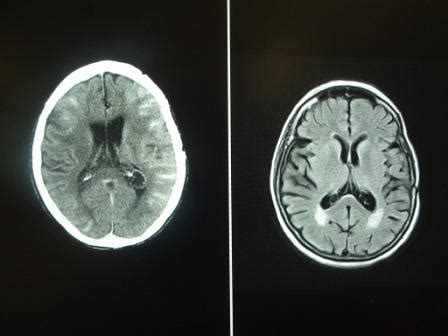 Wat Is Het Verschil Tussen Ct En Mri Scan Advragen Nl 18921 Hot Sex