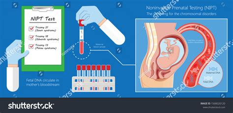 Noninvasive Prenatal Testing Nipt Screening Genetic Stock Vector