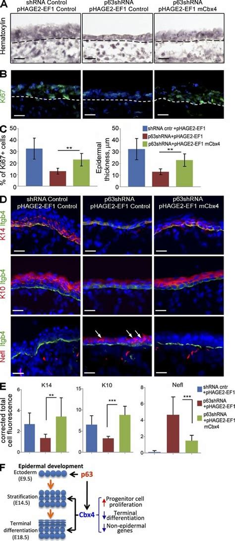 Cbx4 Partially Rescues An Epidermal Phenotype In P63KO Mice A And B