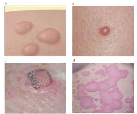 Approach To The Diagnosis Of Skin Disease Part 1 Skin Diseases