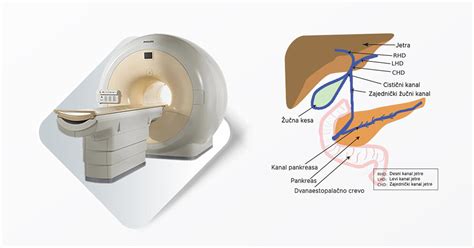 Magnetna Rezonanca MRCP Magnetna Rezonanca Kragujevac