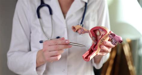 Gynecologist Shows Structure Of Uterus On Model Of Uterus Stock Video