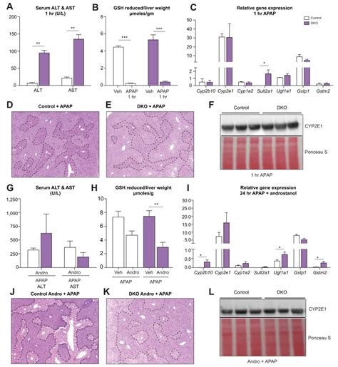 Transcriptomic Analysis Across Liver Diseases Reveals Disease