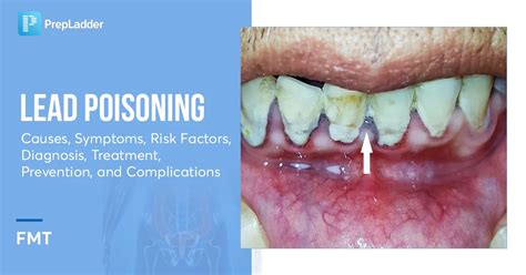 Lead Poisoning Smear