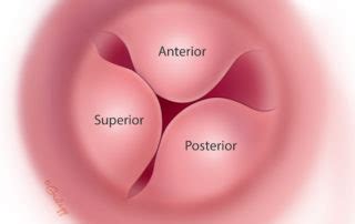 Exostoses of the Ear Canal – Oto Surgery Atlas