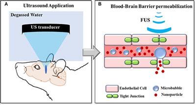 Frontiers Magnetic Resonance Methods For Focused Ultrasound Induced