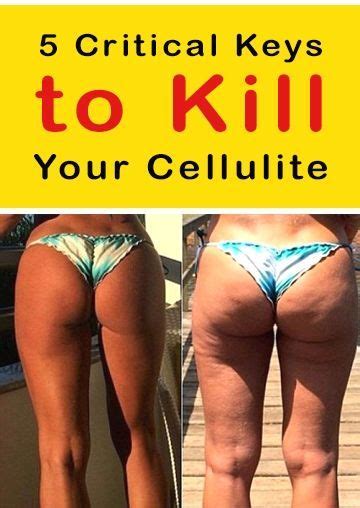 Pin On Cellulite Exercises