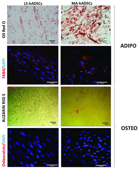 Hadsc In Vitro Differentiation Cells Obtained From Lipoaspirated