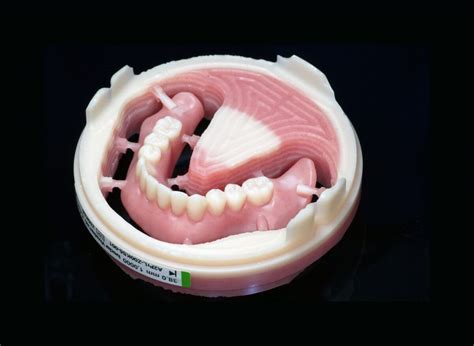 Ivoclar Ivotion Milled Digital Denture Pm7 Mill Digital Denture Lab