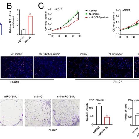 Overexpression Of MiR 379 5p Suppressed The EMT Process Of The