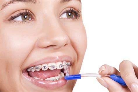 Tips For Keeping Your Braces Clean Orthodontist In Henderson Nv