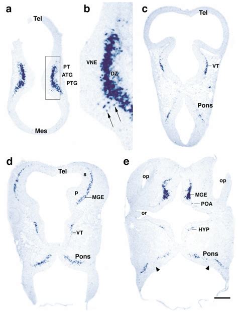 Hybridization Of Digoxigenin Dig Labeled Gad Probe On Cross