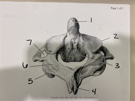 Axis C Diagram Quizlet