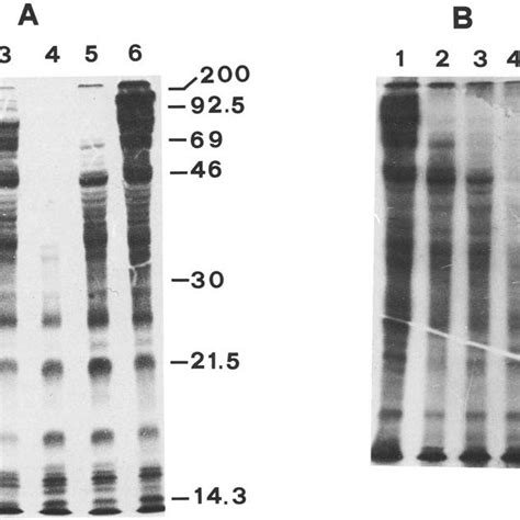 Sds Polyacrylamide Gel Electrophoresis And Fluorography Of