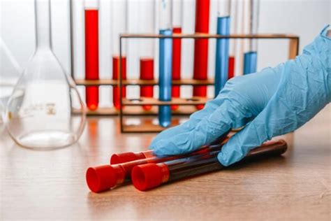 Understanding Biochemical Tests Essential Tools For Health Assessment
