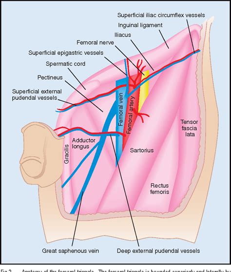 Pdf Modified Inguinal Lymph Node Dissection In Groin Negative | Sexiz Pix