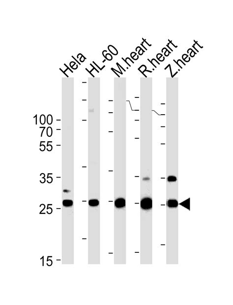 DANRE Sdhb Antibody Center Affinity Purified Rabbit Polyclonal