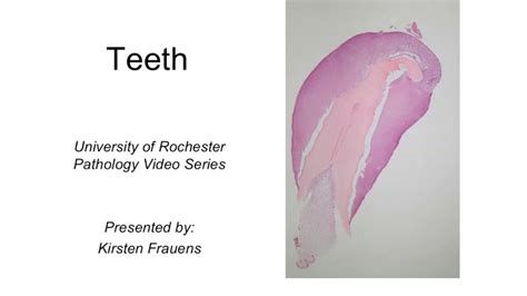 Histology Of The Tooth Youtube