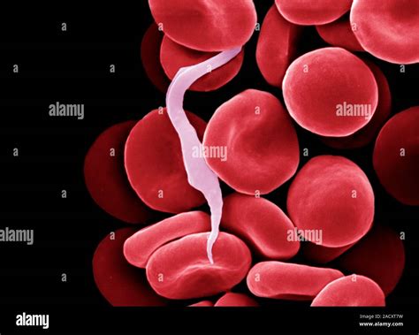 Parasitic Protozoan Pink Amongst Red Blood Cells Coloured Scanning