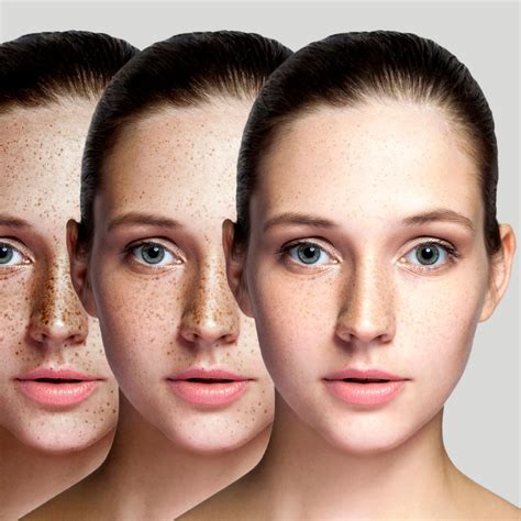 Learn The Foundations Of Pigmentation With The Introduction To