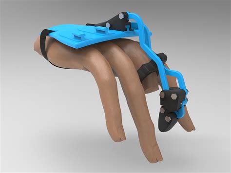 Prosthetic Fingers 3D PRINT PROSTHETIC FINGER Stl File Diy Print Your