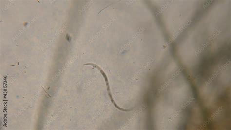 Bacteria Parasites And Worms In Drinking Water Under Microscope