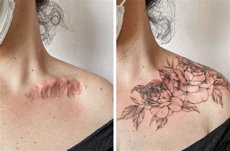 Cover Up Tattoos For Women Tattoos To Cover Scars Scar Tattoo Tatoo