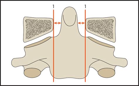 Craniocervical Junction And Cervical Spine Radiology Key