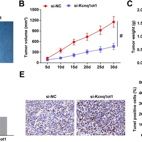 Knocking Down Kcnq Ot Suppresses Tumorigenic Ability Of Cal Cells In