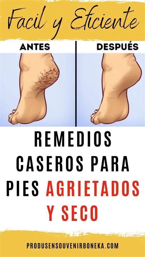 Recetas Incre Bles Para Exfoliar Los Pies Para Que Se Vuelvan Suaves