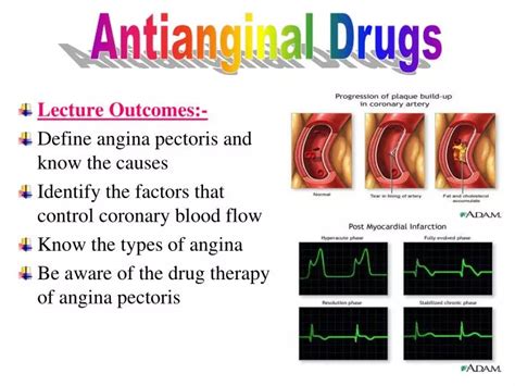 Ppt Lecture Outcomes Define Angina Pectoris And Know The Causes