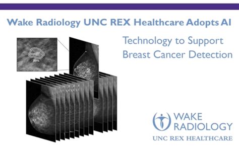 Wake Radiology Unc Rex Healthcare Introduces Profound Ai Wake Radiology