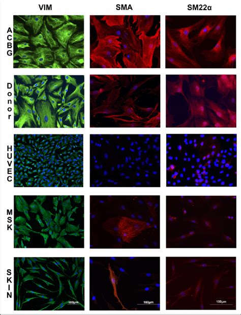 The Cells Derived From Coronary Artery Bypass Graft Cabg Patient