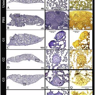 Lung Histopathology Of P Brasiliensis Infected Mice Treated With