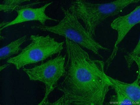 Caspase Cascade Antibodies Proteintech Group 武汉三鹰生物技术有限公司