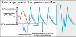 Invasive Monitoring Principles Flashcards Quizlet