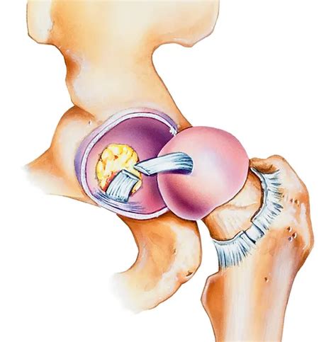 How Can We Address Hip Pain? – City Integrative Rehab