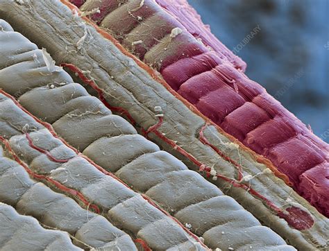 Muscle, SEM - Stock Image - C056/2298 - Science Photo Library 