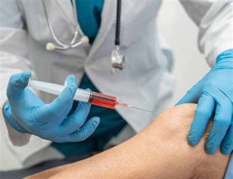 How Prp Therapy Can Help With Knee Pain From Osteoarthritis San Diego