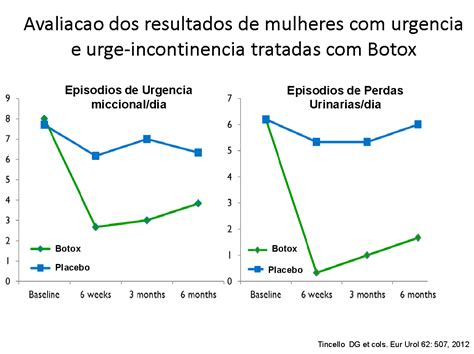 Uso De Toxina Botulínica Dr Paulo Rodrigues