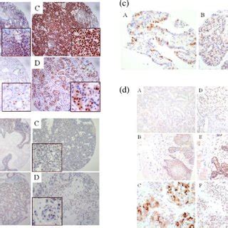 Estrogen Receptor A Expression In Dmba Induced Mammary Tumors And