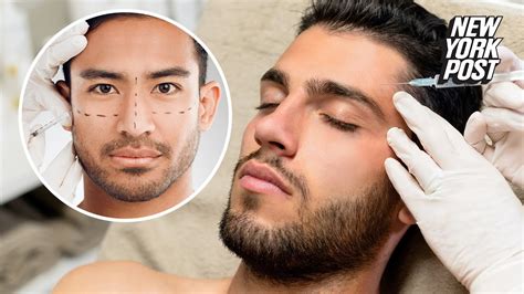 ‘brotox Is The Latest Beauty Trend For Dudes ‘men Want To Look Good