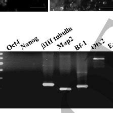 Characterization Of Hipsc Derived Mature Neurons Stage Mn