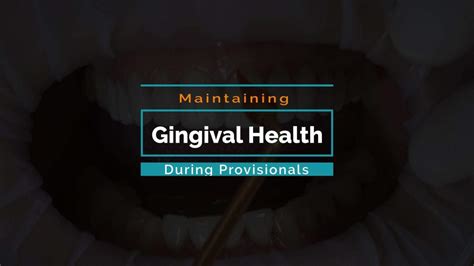 Caring for Gingival Health While in Provisional Veneers - Keating Dental Lab